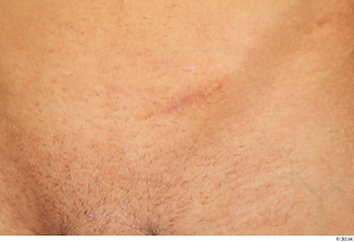 Claudio belly scar skin 0001.jpg